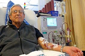 Dialysis life insurance coverage